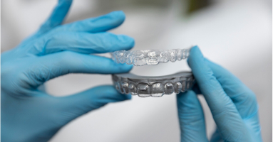 Dental Bridges & Crowns